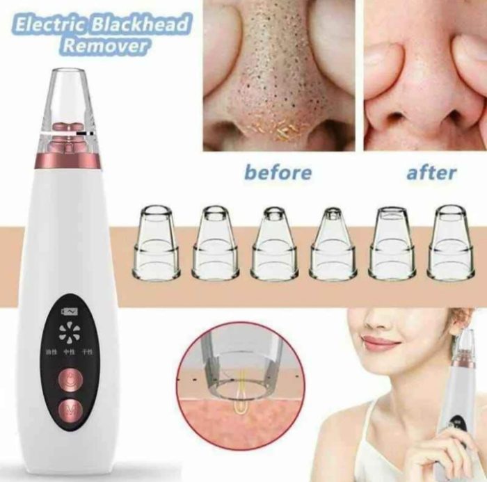 multi-function-blackhead-remover
